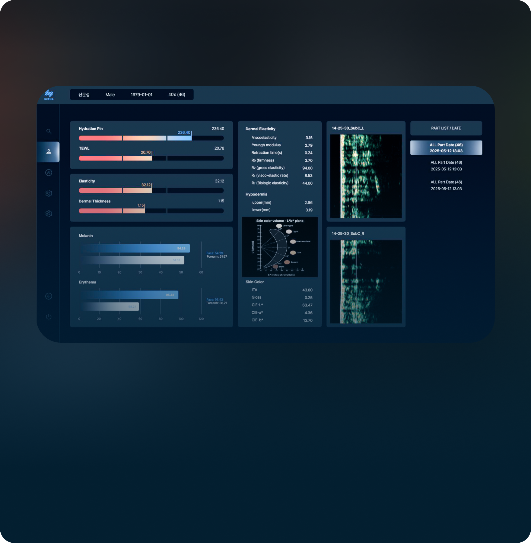 SKENA（スケナ）施術画像